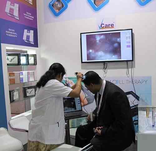 Vcare Super Speciality Hair Clinic Reviews Malakpet Hyderabad